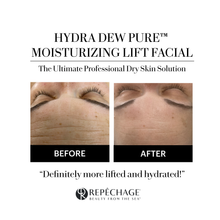 Load image into Gallery viewer, HYDRA-DEW STARTER KIT