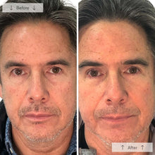 Load image into Gallery viewer, Omnilux Men