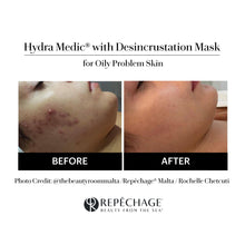 Load image into Gallery viewer, HYDRA-MEDIC™️