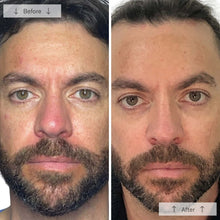Load image into Gallery viewer, Omnilux Men
