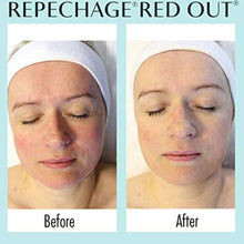 Load image into Gallery viewer, RED-OUT© SOOTHING SHEET MASK
